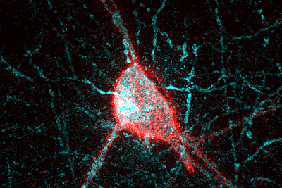 A parvalbumin interneuron surrounded by the perineuronal net.