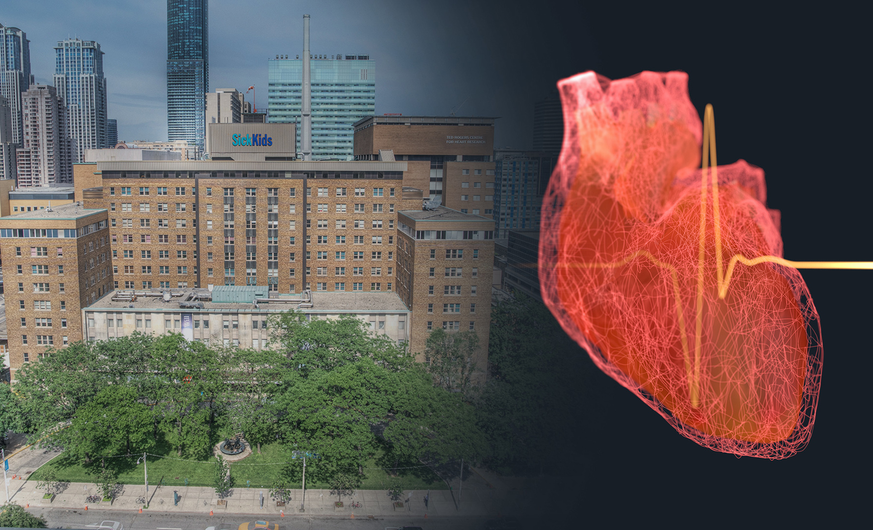 Collage showing SickKids hospital exterior on University Avenue next to a heartbeat illustration