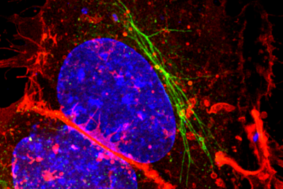 Samonella bacteria in a human cell